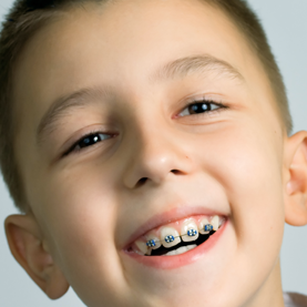Tratamientos de ortodoncia para niños